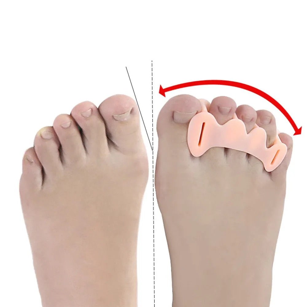 Bunion Corrector Relief Relieve Your Pain