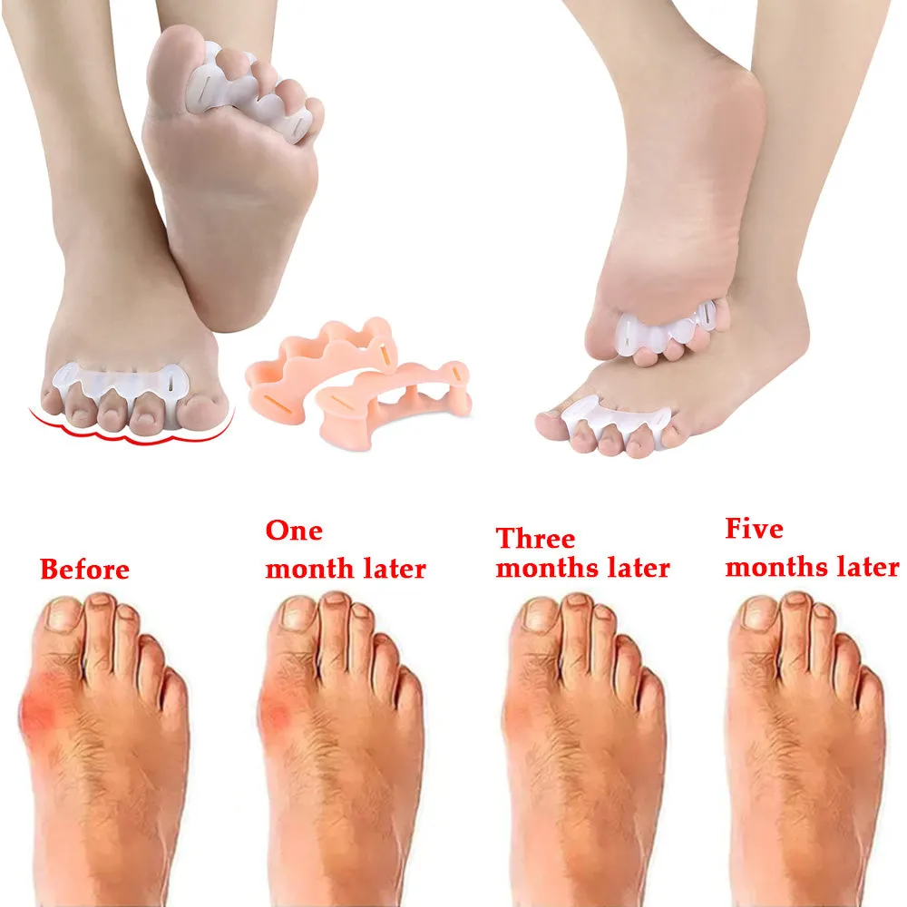 Bunion Corrector Relief Relieve Your Pain